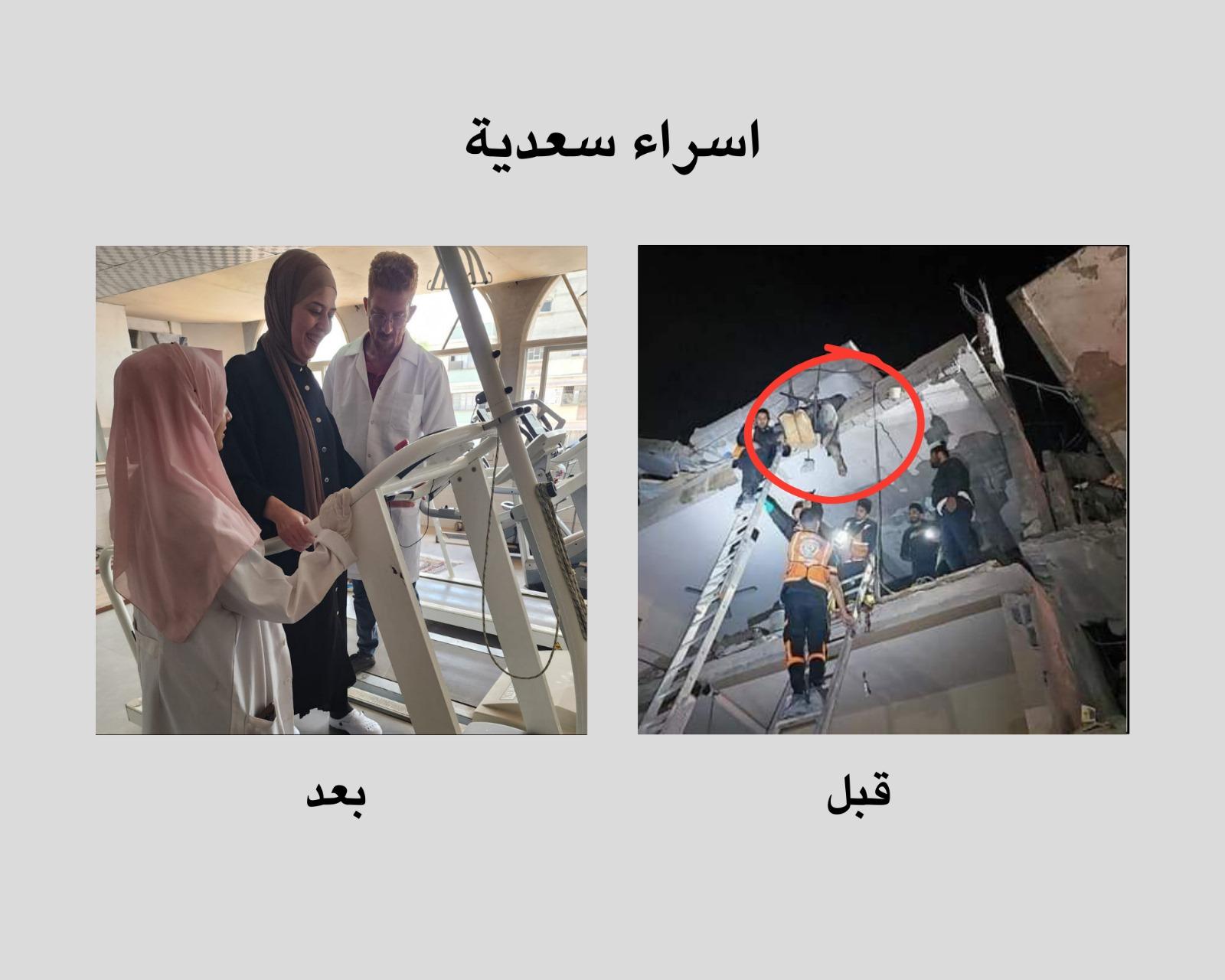 إسراء سعدية: ثلاث ساعات معلقة من الألم إلى الأمل - قصص ملهمة من قسم العلاج الطبيعي في مستشفى الأمل