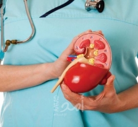 النوبات الكلوية.. أسبابها والأشخاص المعرضون للخطر وطرق الوقاية