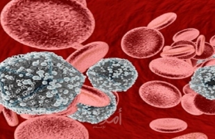 هل يشهد العام المقبل علاج نهائي لمرض الإيدز