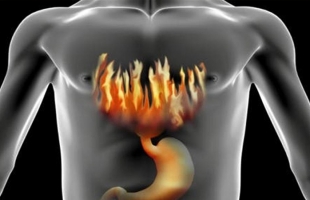 أفضل أطعمة لعلاج حموضة المعدة فى رمضان