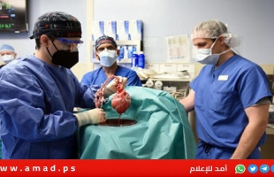للمرة الثانية.. جراحون ينجحون في زراعة كلية خنزير لمريض حي