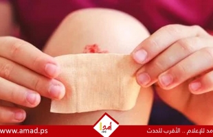 خبراء الصحة يحذرون من استخدام المناديل المبللة الخالية من الكحول على الجروح