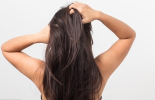 تخلصى من الحكة والإحراج بوصفات طبيعية لعلاج قشرة الرأس