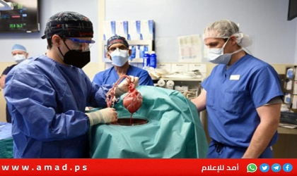 للمرة الثانية.. جراحون ينجحون في زراعة كلية خنزير لمريض حي